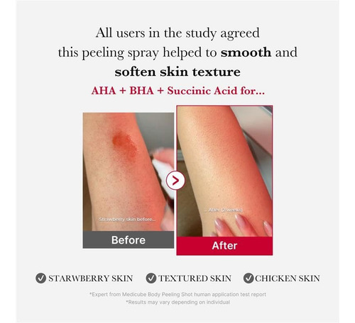 Medicube Exfoliante Corporal En Spray - Red Body Peeling Sho Sin Fragancia