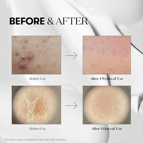 Vt Cosmetics Reedle Shot 300 Suero Microagujas Exosomas