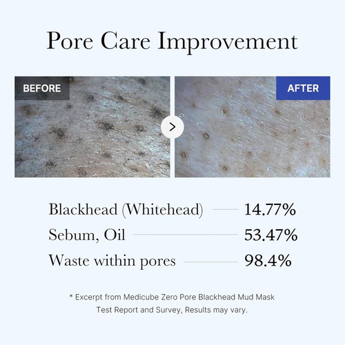 Medicube Máscara Facial De Barro De Puntos Negros Zero Pore Todo Tipo De Piel
