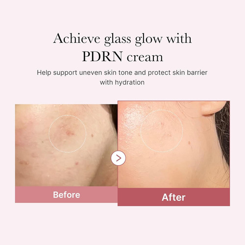 Medicube Salmon Dna Pdrn Crema Hidratante Hialurónica Rosa Todo Tipo De Piel Día/noche