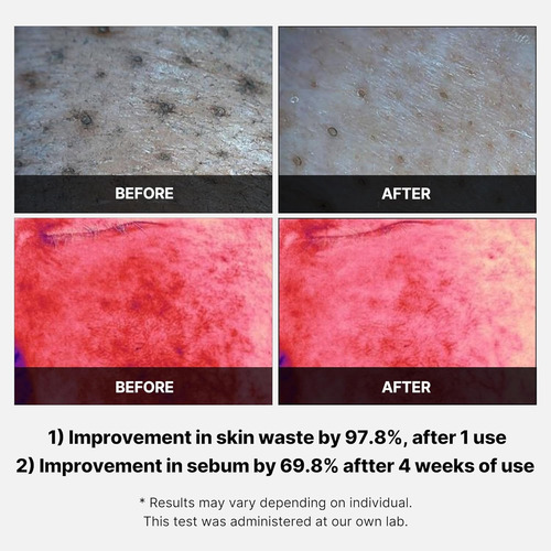 Medicube Almohadillas Red Succinic Acid Peeling Facial Grasa Noche