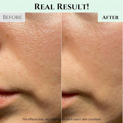 Beauty Of Joseon Green Plum Refreshing Gel Limpiador Acne