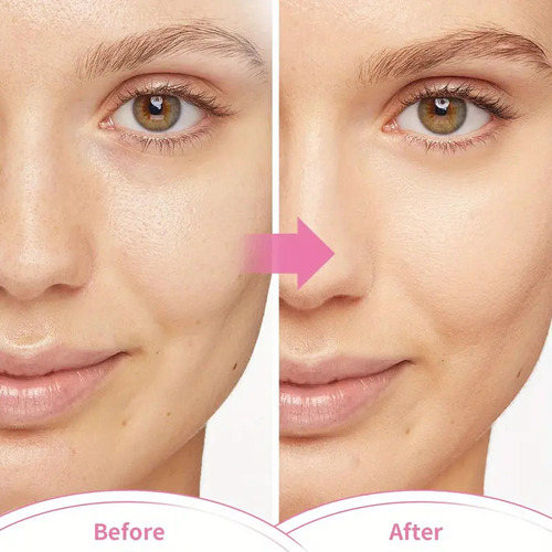 Mascarilla Facial De Gel Reutilizable Frío/calor Anti-ojeras Todo Tipo De Piel