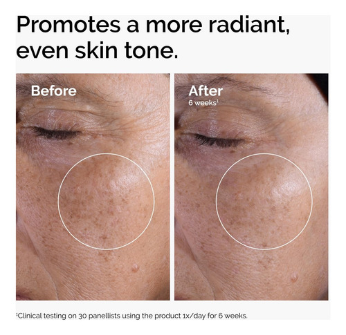 Loción Glycolic Acid 7% Toning Solution The Ordinary Exfolia Todo Tipo De Piel Noche