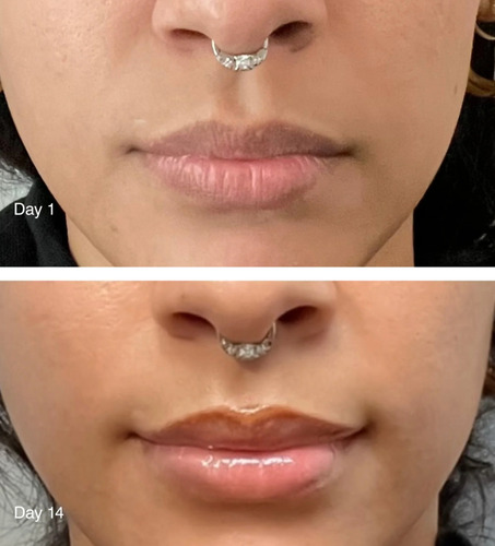 Rhode - Peptide Lip Treatment By Hailey Bieber Salted Caramel