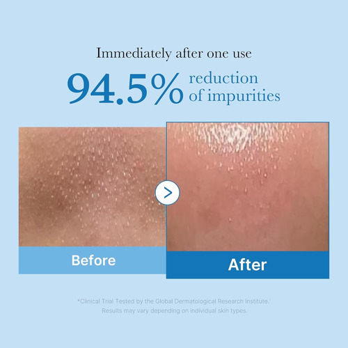 Medicube Zero Pore Blackhead Deep Cleansing Oil Limpiador