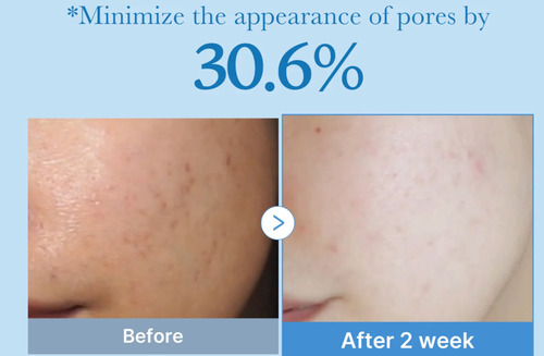 Medicube Zero Pore Tonico Facial Reductor De Poros E Hidrata Normal Grasa Mixta Sensible Día/noche