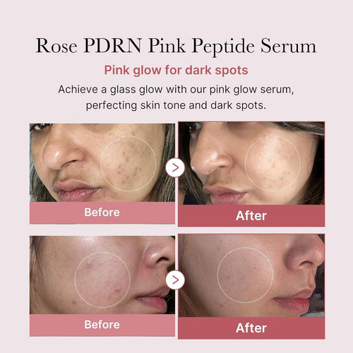 Sérum Facial Medicube Suero De Péptidos Rosa Pdrn 30 Ml Para Uso Diurno Y Nocturno Para Todo Tipo De Piel