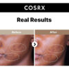 Cosrx The Alpha-arbutin 2 Serum Aclara Cicatrices Post-acné Todo Tipo De Piel Día/noche